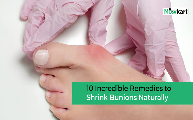 10 Incredible Remedies to Shrink Bunions Naturally