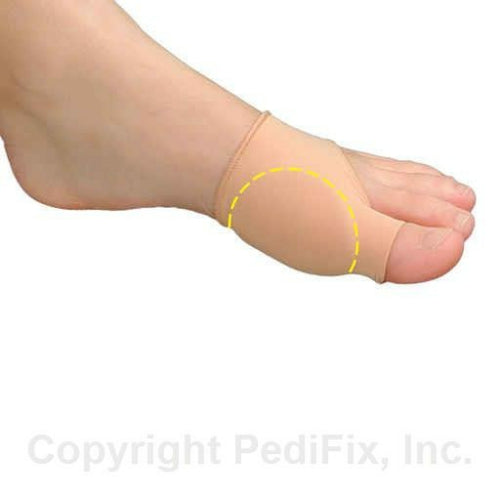 Pedifix Bunion Relief Sleeve, Small