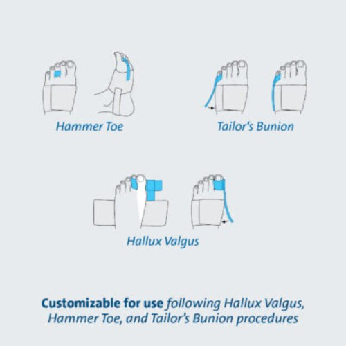 Darco Toe Alignment Splint for Hallux Valgus and Bunion Treatment